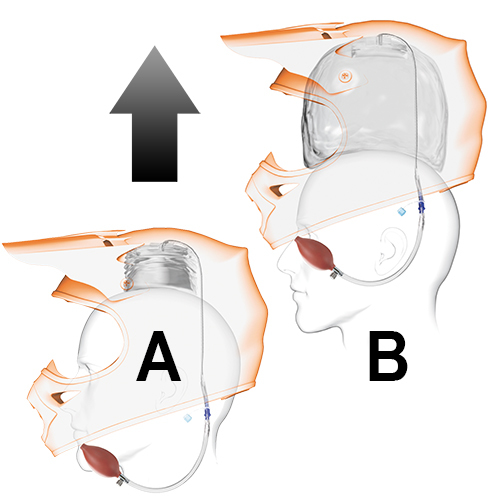 Simpson Helmet Eject System